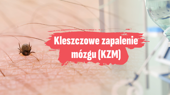 Kleszczowe zapalenie mózgu - co powinieneś wiedzieć?