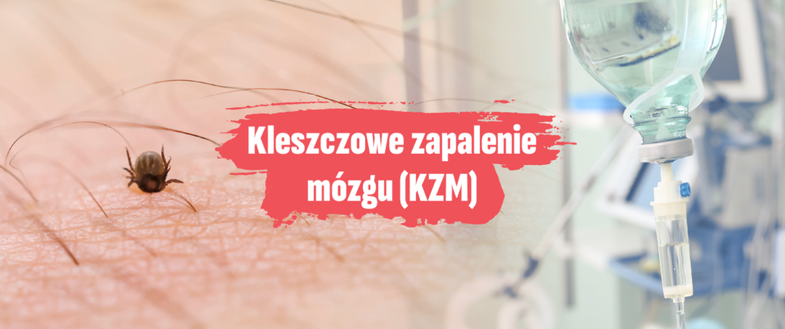 Kleszczowe zapalenie mózgu - co powinieneś wiedzieć?